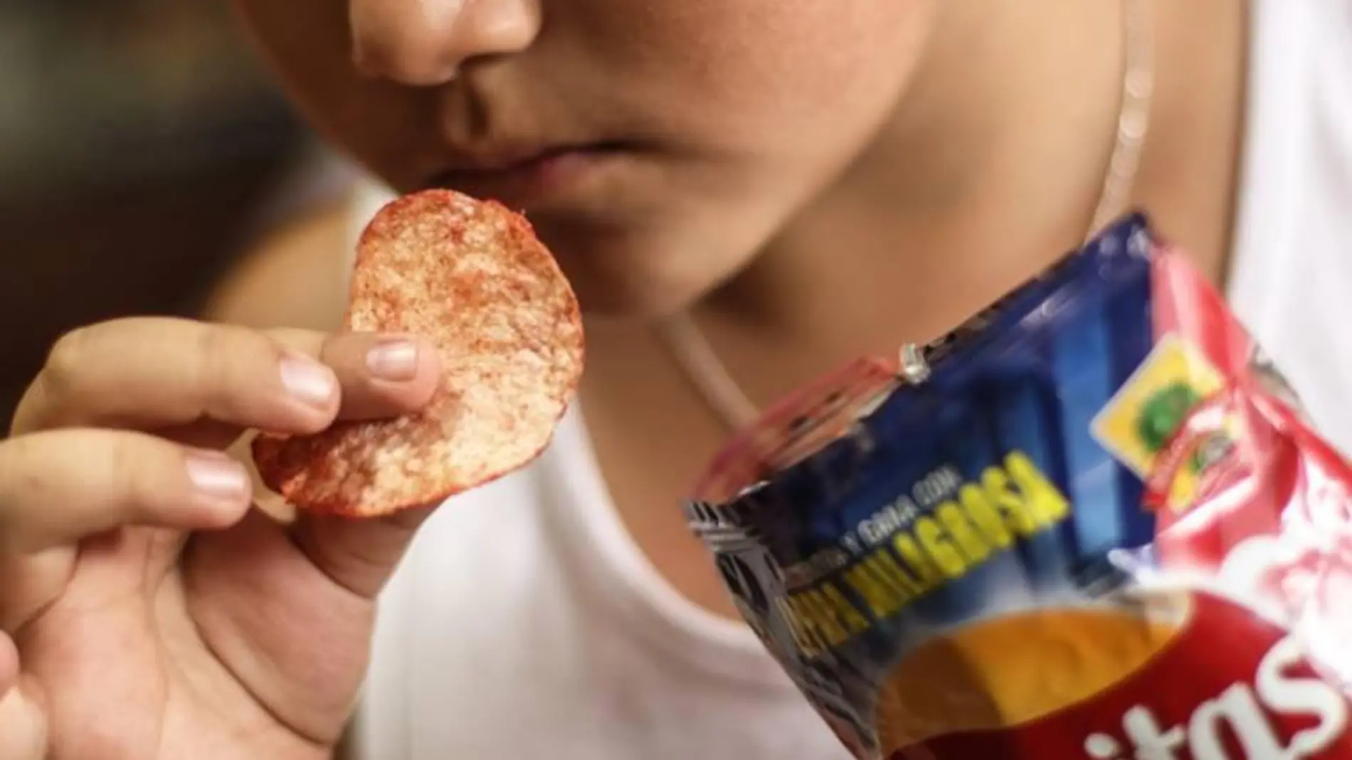 Comida Chatarra Obesidad